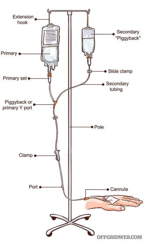  iv|What to know about IV therapy